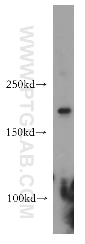 Western Blot (WB) analysis of Jurkat cells using HCFC1 Polyclonal antibody (19358-1-AP)