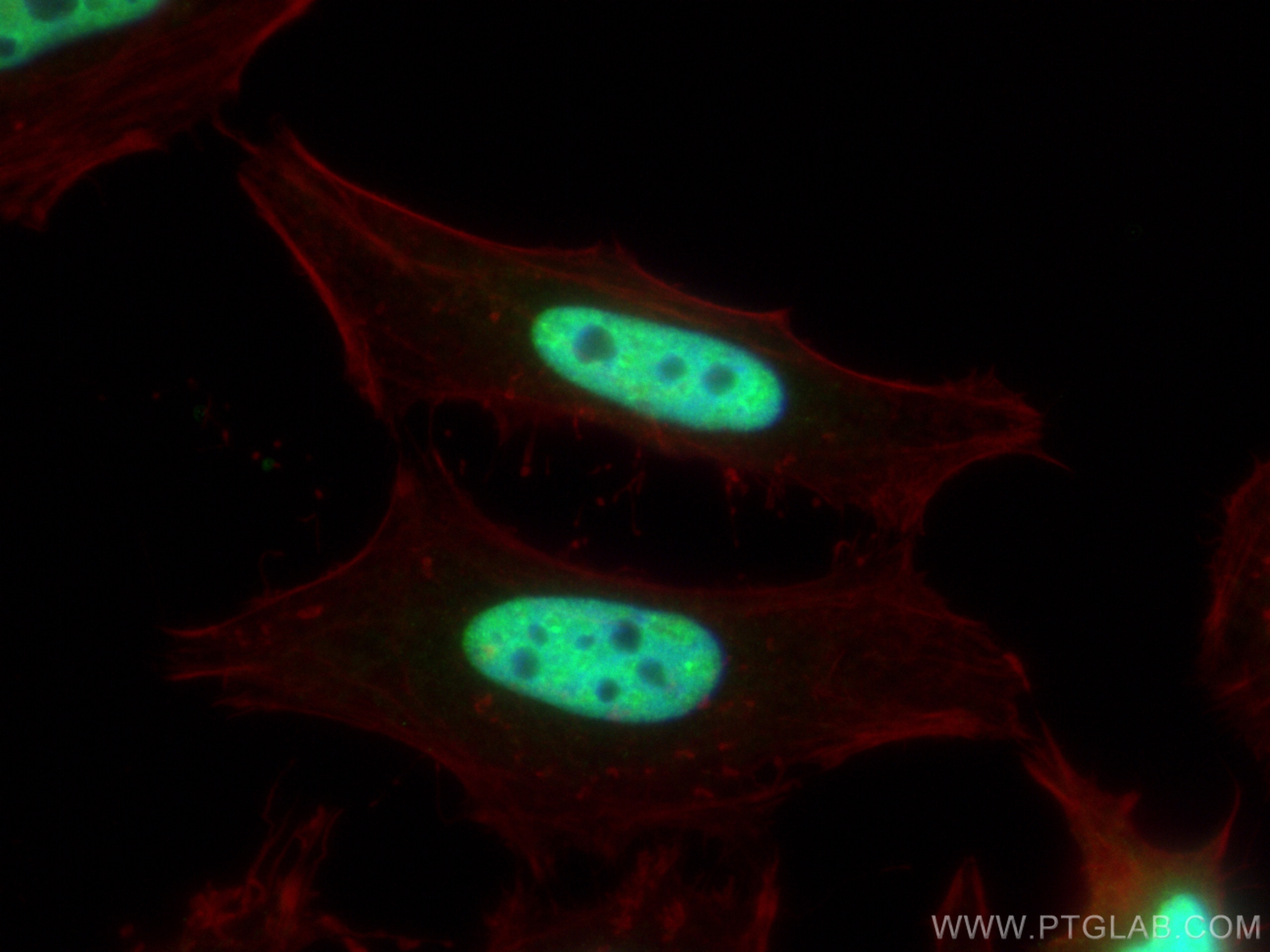 Immunofluorescence (IF) / fluorescent staining of HeLa cells using HCFC1 Polyclonal antibody (28569-1-AP)