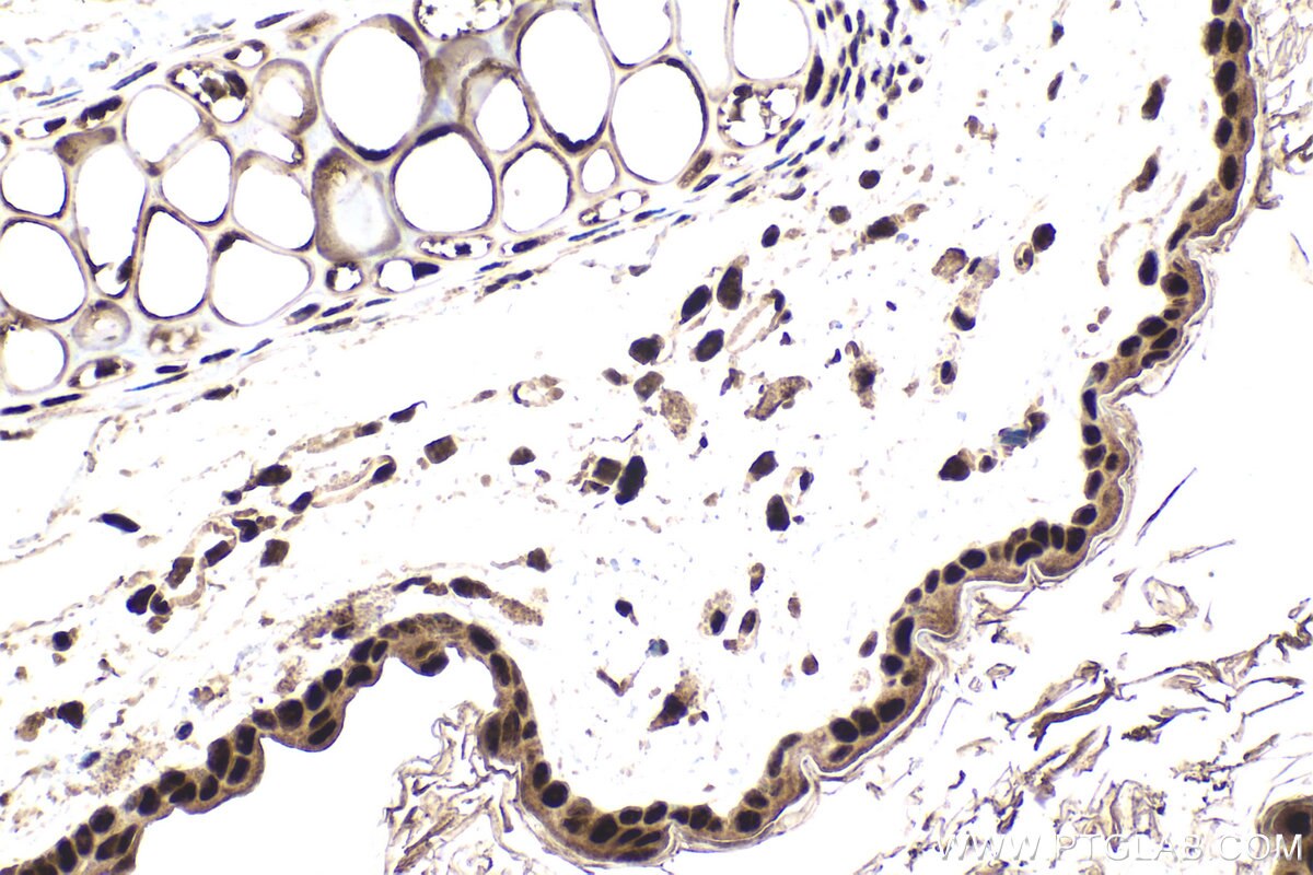 Immunohistochemistry (IHC) staining of mouse skin tissue using HCFC1 Polyclonal antibody (28569-1-AP)