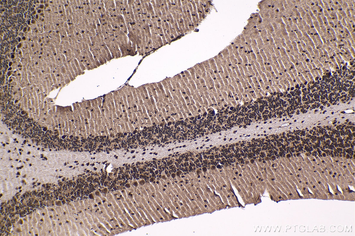 Immunohistochemistry (IHC) staining of mouse cerebellum tissue using HCFC1 Polyclonal antibody (28569-1-AP)