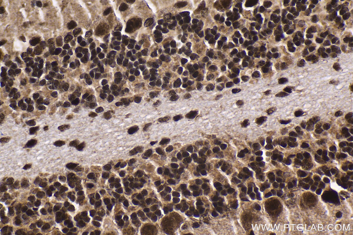 Immunohistochemistry (IHC) staining of mouse cerebellum tissue using HCFC1 Polyclonal antibody (28569-1-AP)