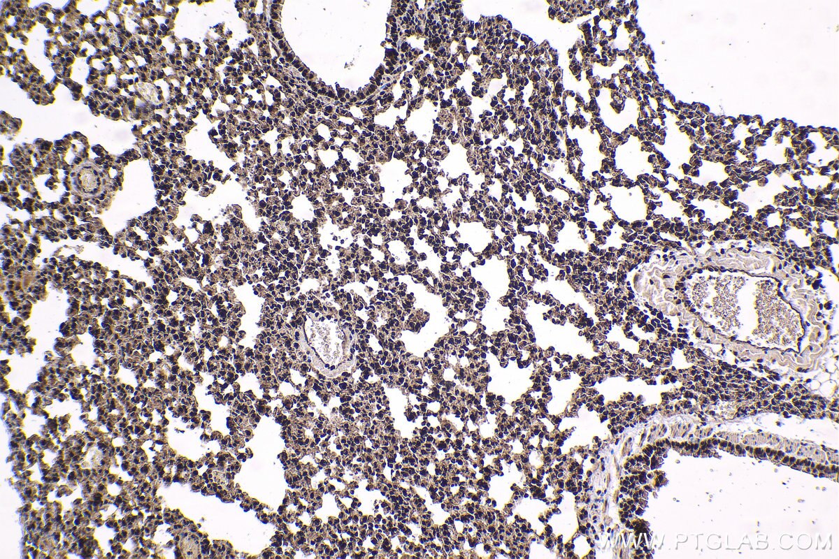 Immunohistochemistry (IHC) staining of mouse lung tissue using HCFC1 Polyclonal antibody (28569-1-AP)