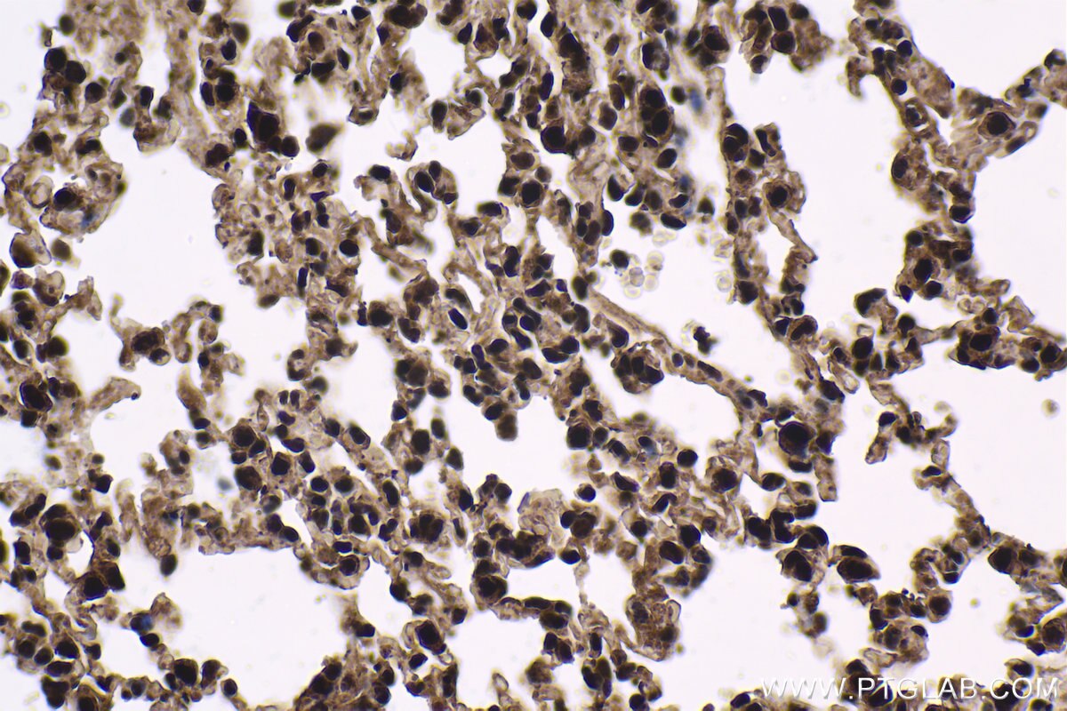 Immunohistochemistry (IHC) staining of mouse lung tissue using HCFC1 Polyclonal antibody (28569-1-AP)