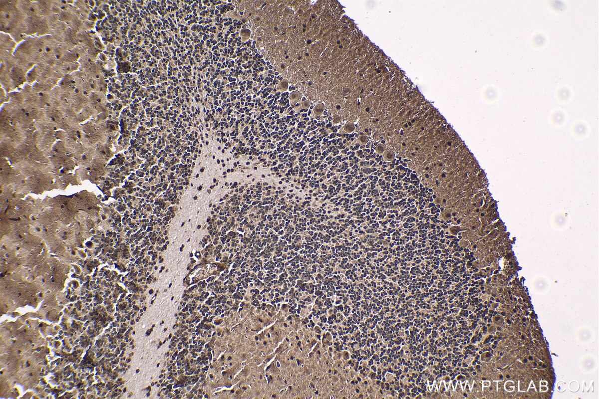 Immunohistochemistry (IHC) staining of rat cerebellum tissue using HCFC1 Polyclonal antibody (28569-1-AP)