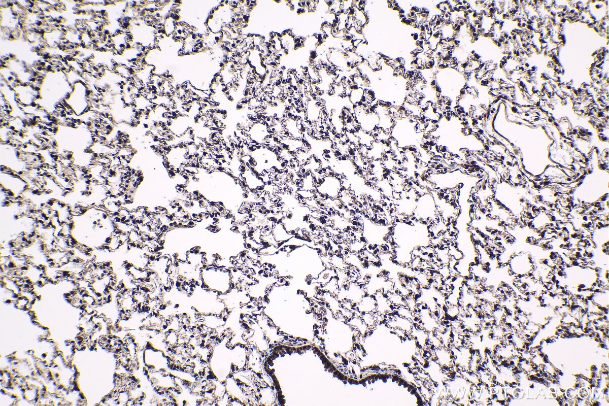 Immunohistochemistry (IHC) staining of rat lung tissue using HCFC1 Polyclonal antibody (28569-1-AP)