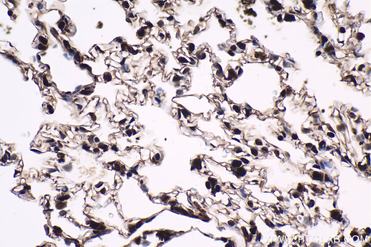 Immunohistochemistry (IHC) staining of rat lung tissue using HCFC1 Polyclonal antibody (28569-1-AP)