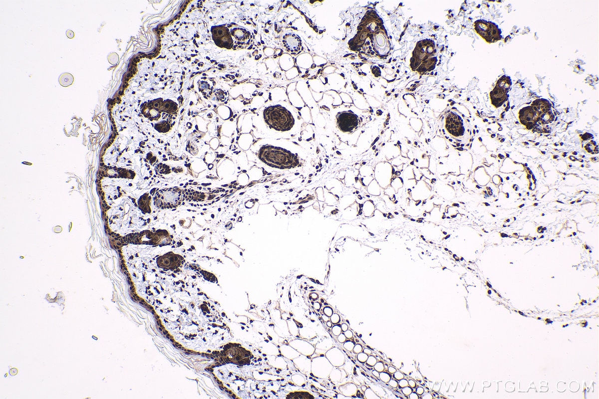 Immunohistochemistry (IHC) staining of rat skin tissue using HCFC1 Polyclonal antibody (28569-1-AP)