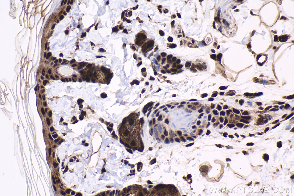 Immunohistochemistry (IHC) staining of rat skin tissue using HCFC1 Polyclonal antibody (28569-1-AP)
