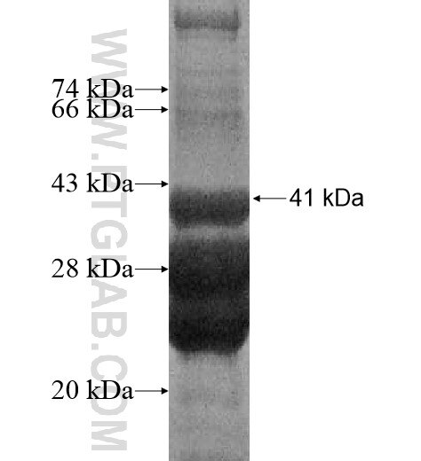 HCFC1R1 fusion protein Ag11816 SDS-PAGE