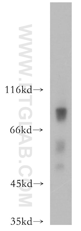 Western Blot (WB) analysis of mouse testis tissue using HCFC2 Polyclonal antibody (13567-1-AP)