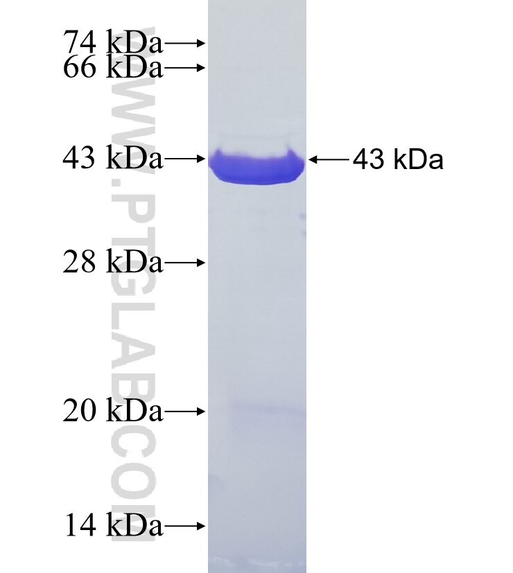 HCG22 fusion protein Ag35544 SDS-PAGE