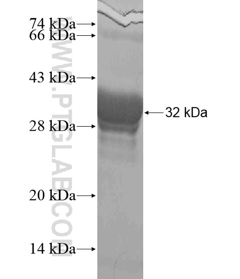 HCG9 fusion protein Ag20483 SDS-PAGE