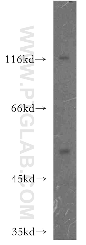 Western Blot (WB) analysis of Jurkat cells using HCK Polyclonal antibody (11600-1-AP)