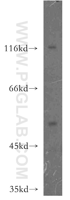 Western Blot (WB) analysis of Jurkat cells using HCK Polyclonal antibody (11600-1-AP)