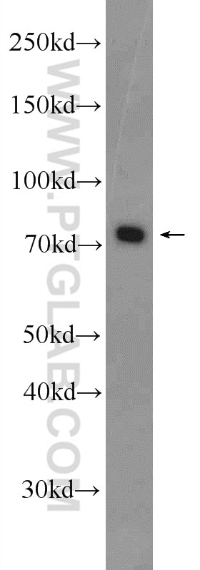 Western Blot (WB) analysis of Jurkat cells using HCLS1 Polyclonal antibody (25003-1-AP)