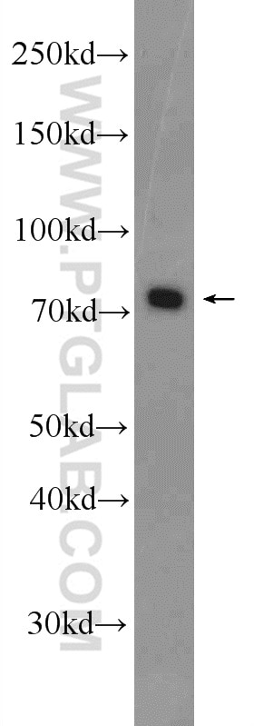 WB analysis of Jurkat using 25003-1-AP