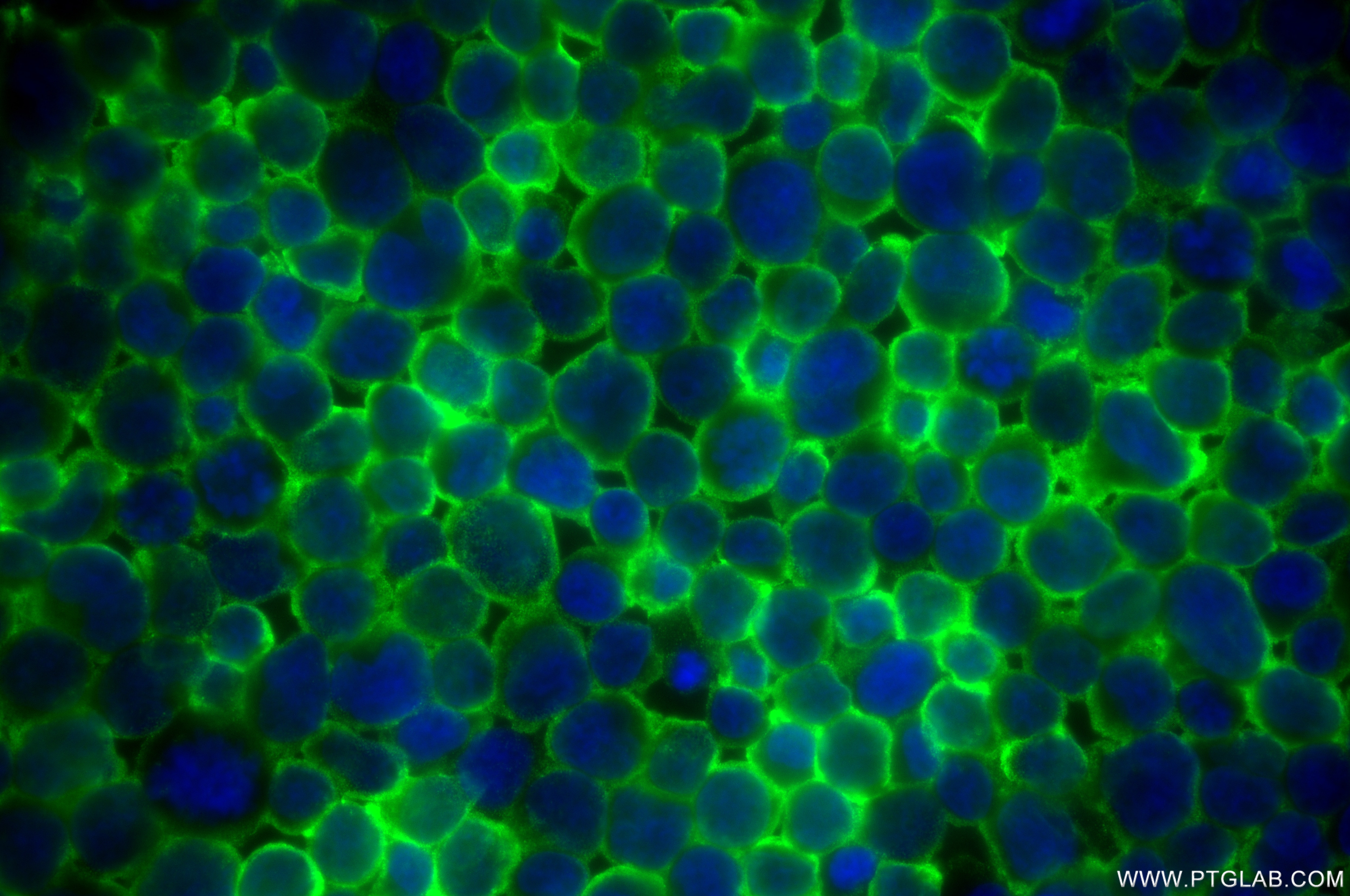 Immunofluorescence (IF) / fluorescent staining of Jurkat cells using HCLS1 Recombinant antibody (85114-1-RR)