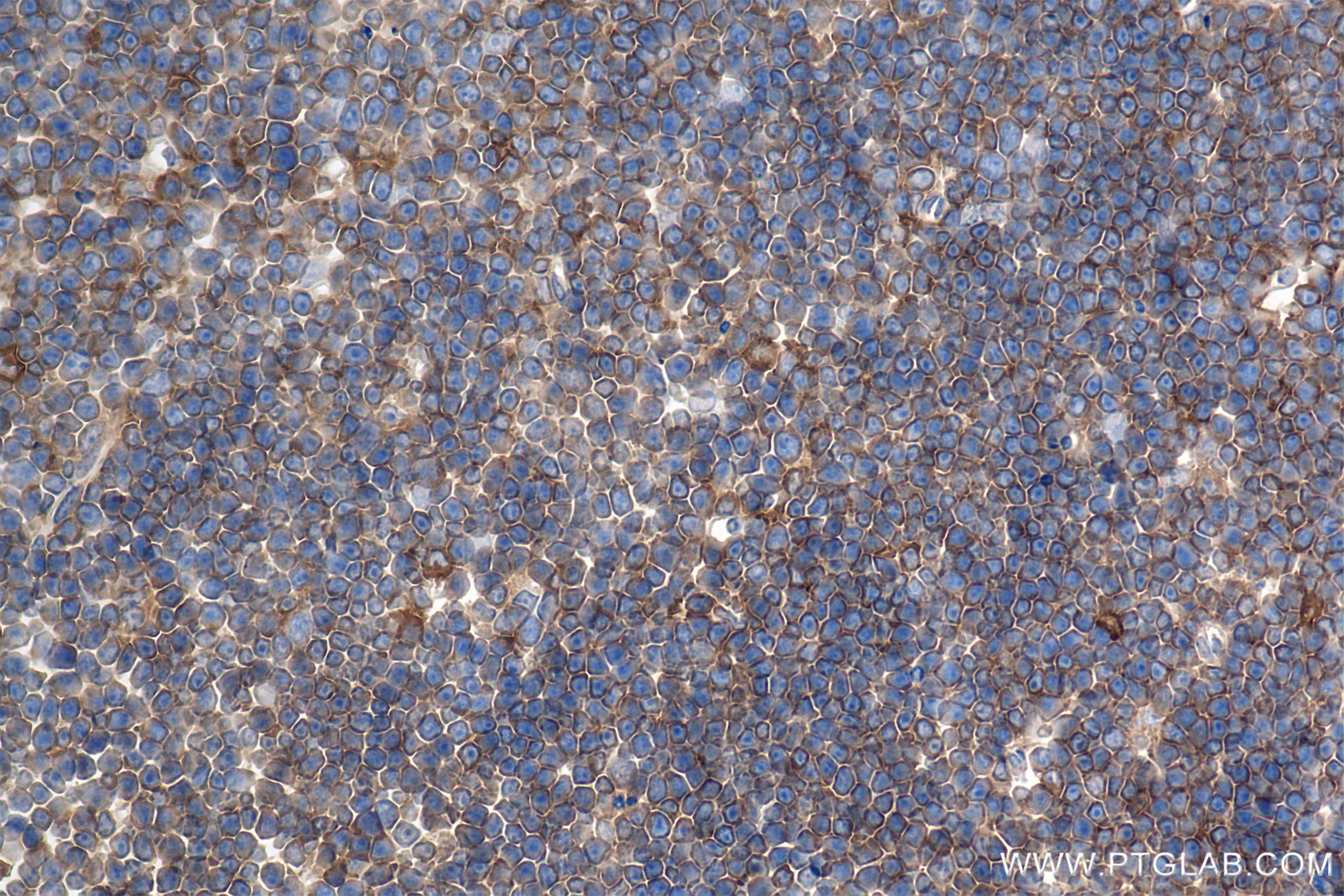 Immunohistochemistry (IHC) staining of mouse thymus tissue using HCLS1 Recombinant monoclonal antibody (85114-1-RR)