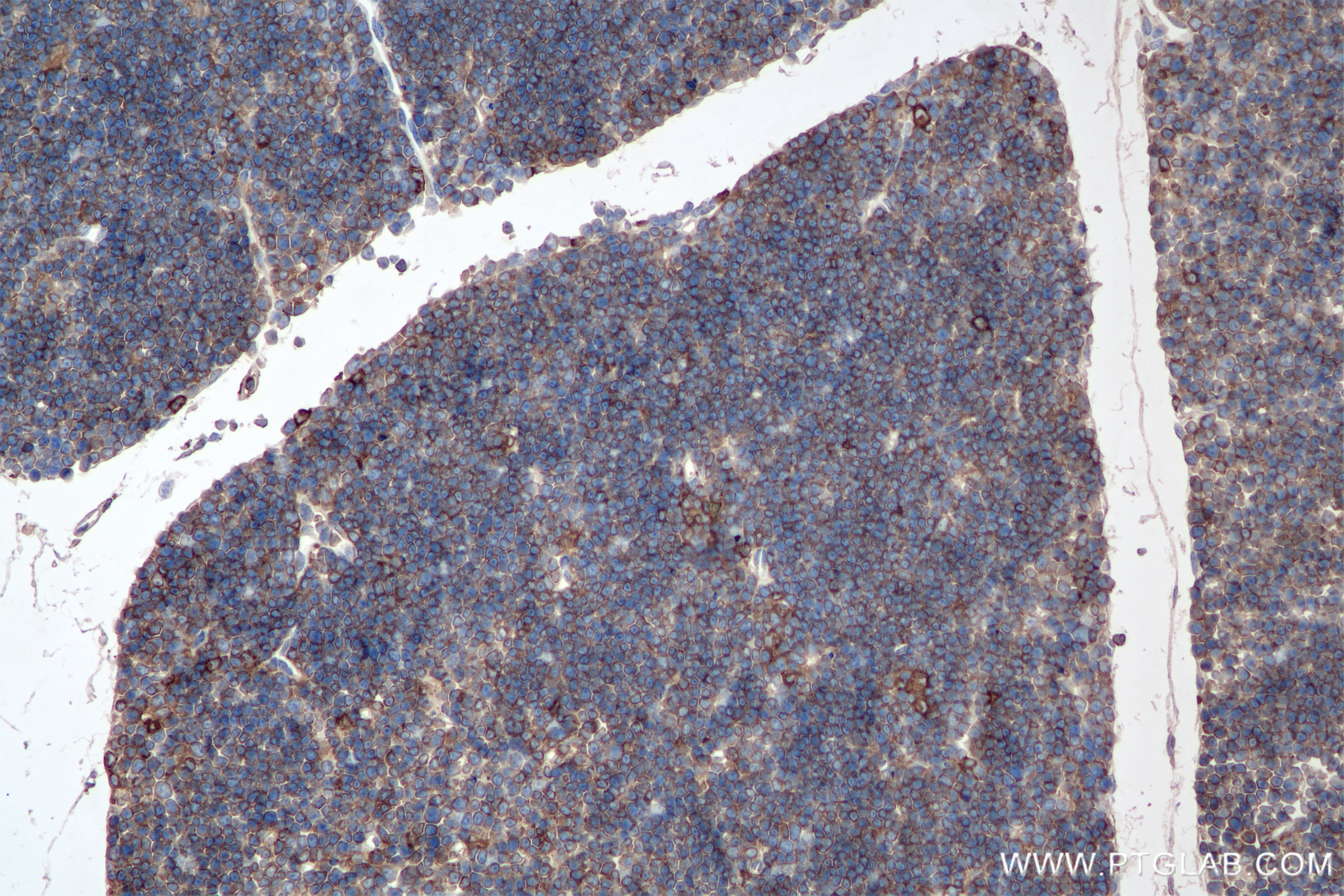 Immunohistochemistry (IHC) staining of mouse thymus tissue using HCLS1 Recombinant monoclonal antibody (85114-1-RR)