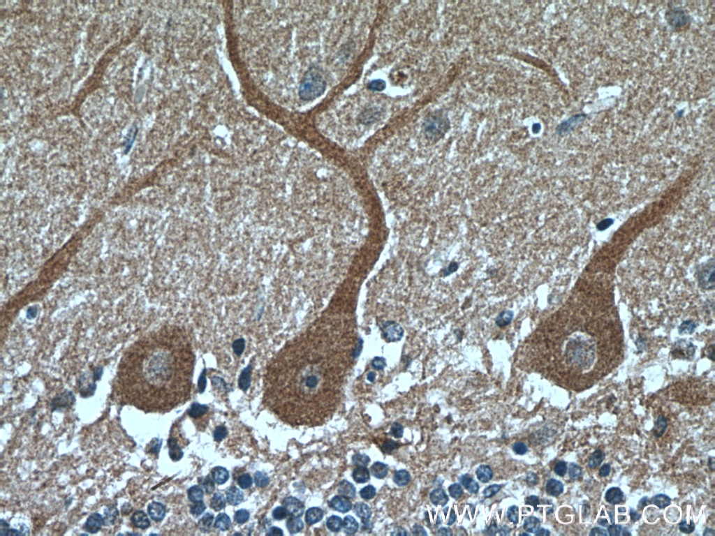 Immunohistochemistry (IHC) staining of human cerebellum tissue using HCN1 Polyclonal antibody (55222-1-AP)