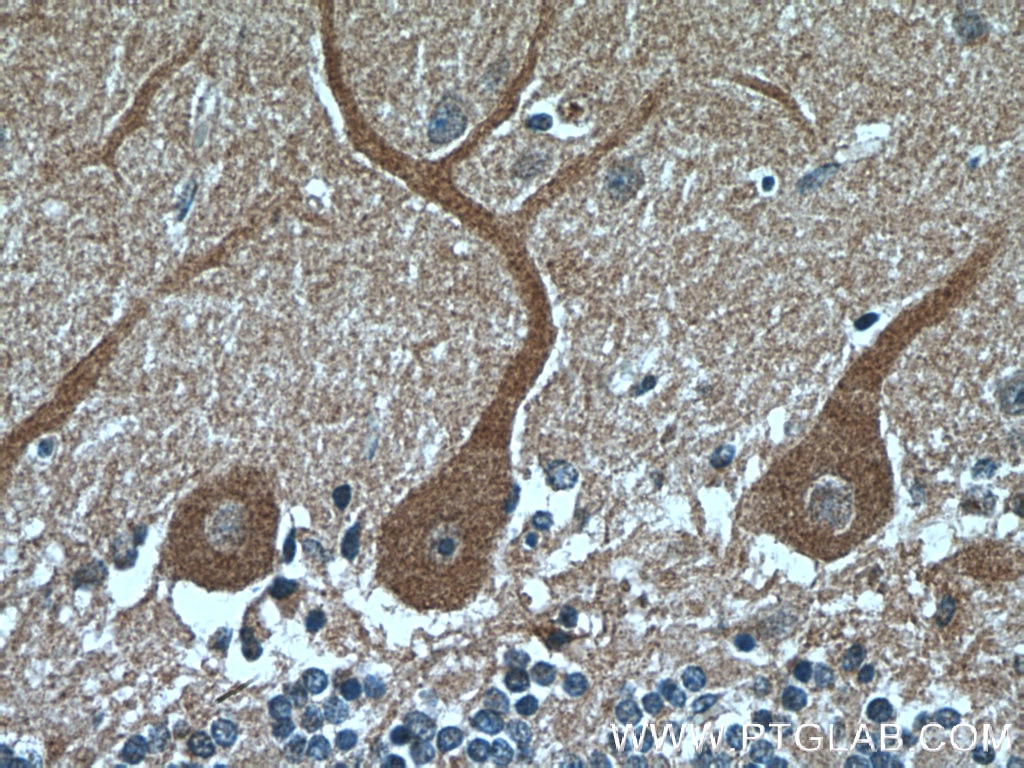 IHC staining of human cerebellum using 55222-1-AP