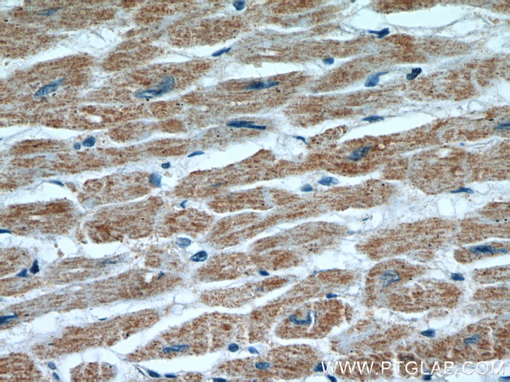 Immunohistochemistry (IHC) staining of human heart tissue using HCN1 Polyclonal antibody (55222-1-AP)