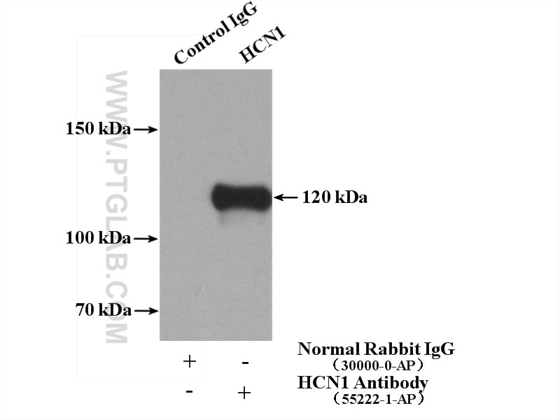 Immunoprecipitation (IP) experiment of mouse brain tissue using HCN1 Polyclonal antibody (55222-1-AP)