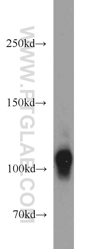 Western Blot (WB) analysis of mouse brain tissue using HCN1 Polyclonal antibody (55222-1-AP)