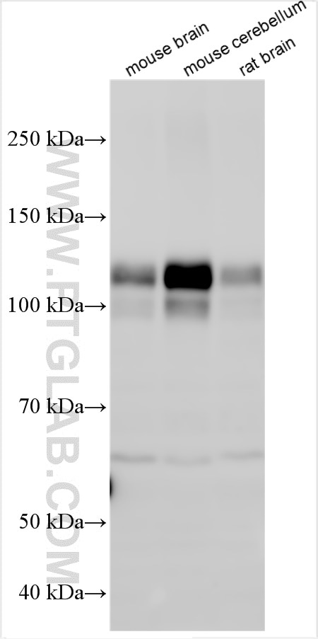 Western Blot (WB) analysis of various lysates using HCN2 Polyclonal antibody (30946-1-AP)