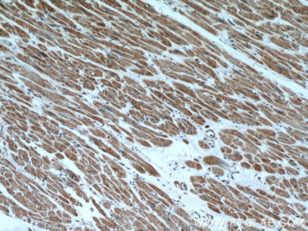 Immunohistochemistry (IHC) staining of human heart tissue using HCN2 Polyclonal antibody (55245-1-AP)