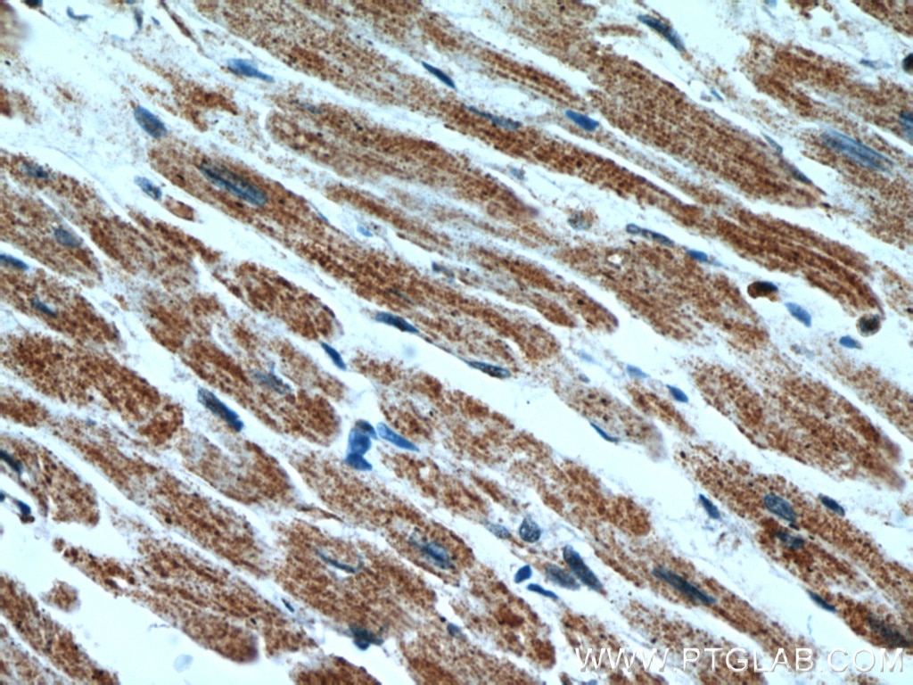 Immunohistochemistry (IHC) staining of human heart tissue using HCN2 Polyclonal antibody (55245-1-AP)