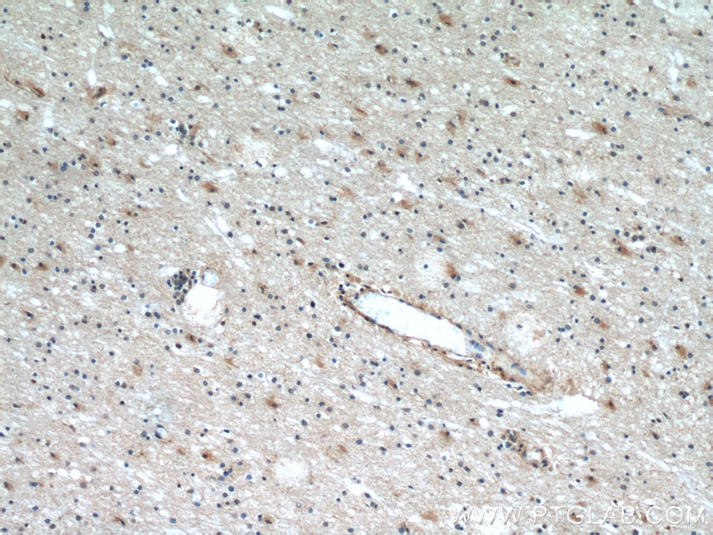 IHC staining of human brain using 55245-1-AP