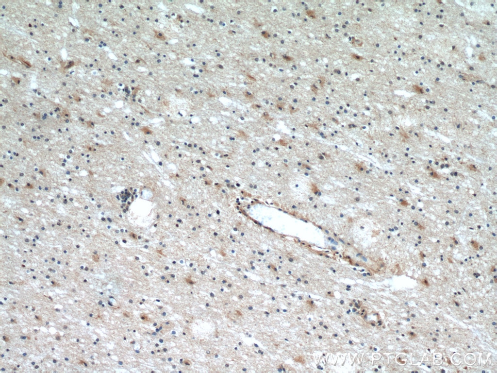 Immunohistochemistry (IHC) staining of human brain tissue using HCN2 Polyclonal antibody (55245-1-AP)