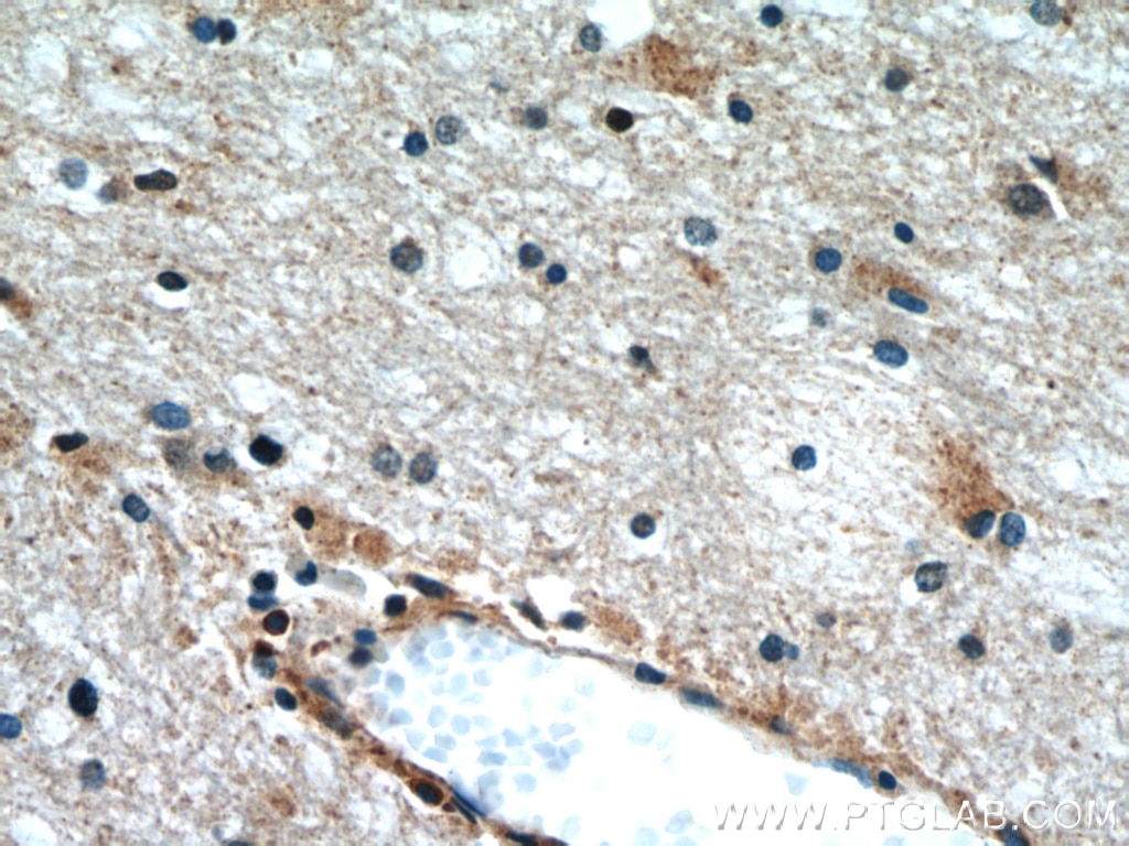 Immunohistochemistry (IHC) staining of human brain tissue using HCN2 Polyclonal antibody (55245-1-AP)
