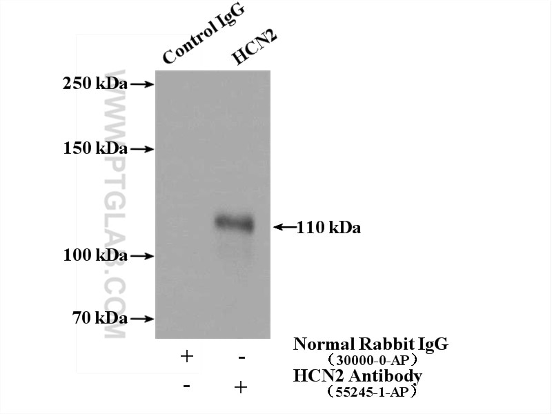 Immunoprecipitation (IP) experiment of mouse brain tissue using HCN2 Polyclonal antibody (55245-1-AP)