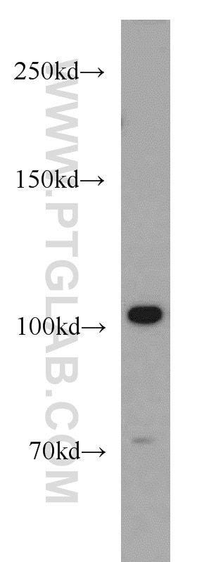 Western Blot (WB) analysis of Jurkat cells using HCN2 Polyclonal antibody (55245-1-AP)