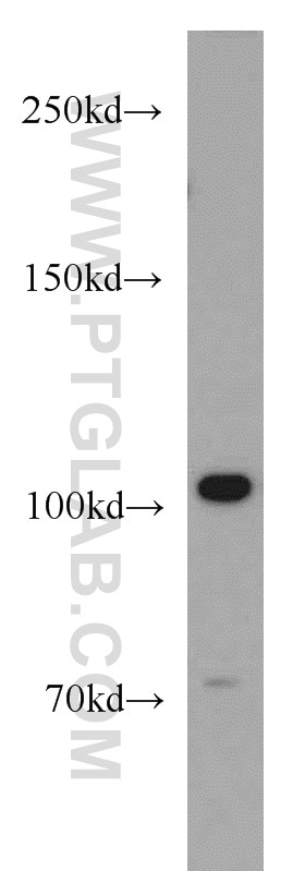 WB analysis of Jurkat using 55245-1-AP
