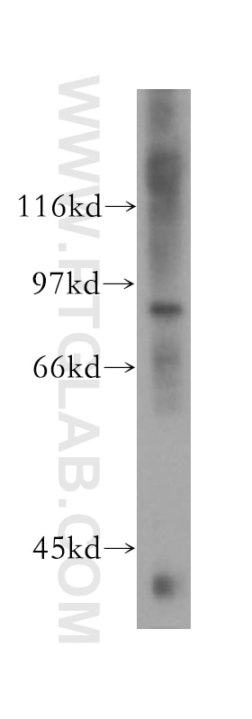 Western Blot (WB) analysis of human kidney tissue using HCN3 Polyclonal antibody (13745-1-AP)