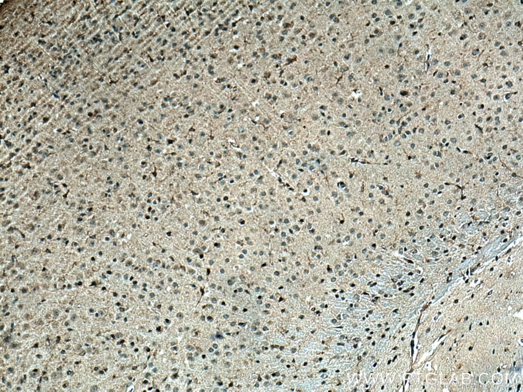 Immunohistochemistry (IHC) staining of mouse brain tissue using HCRTR1 Polyclonal antibody (18370-1-AP)