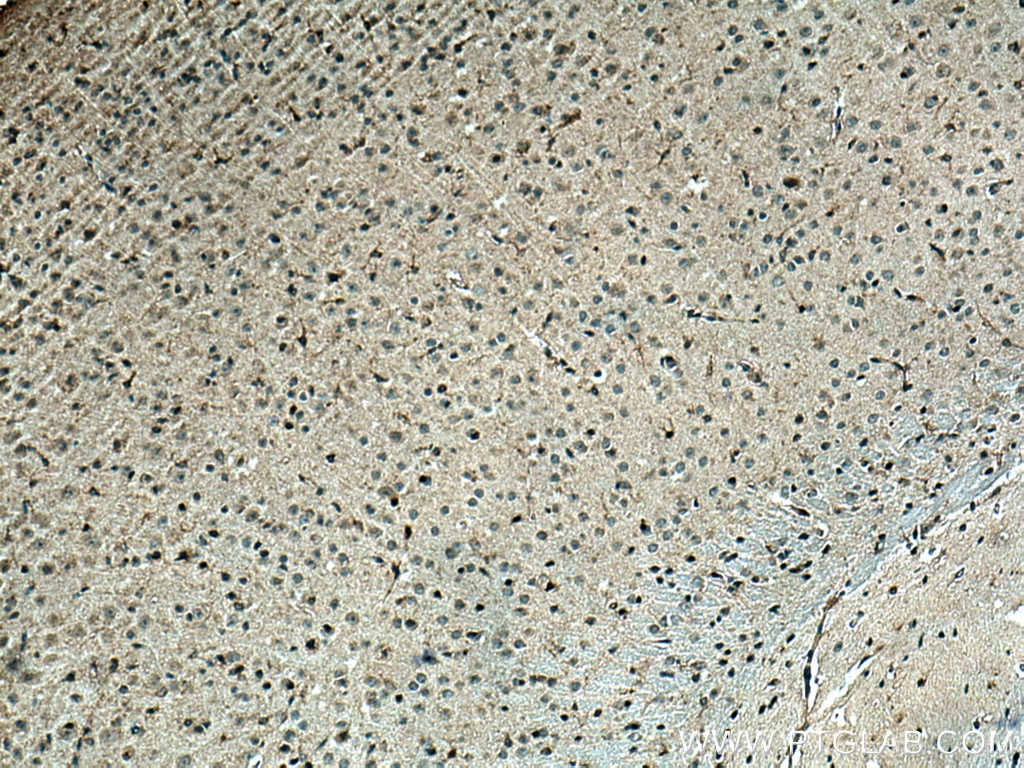 Immunohistochemistry (IHC) staining of mouse brain tissue using Orexin receptor 1 Polyclonal antibody (18370-1-AP)