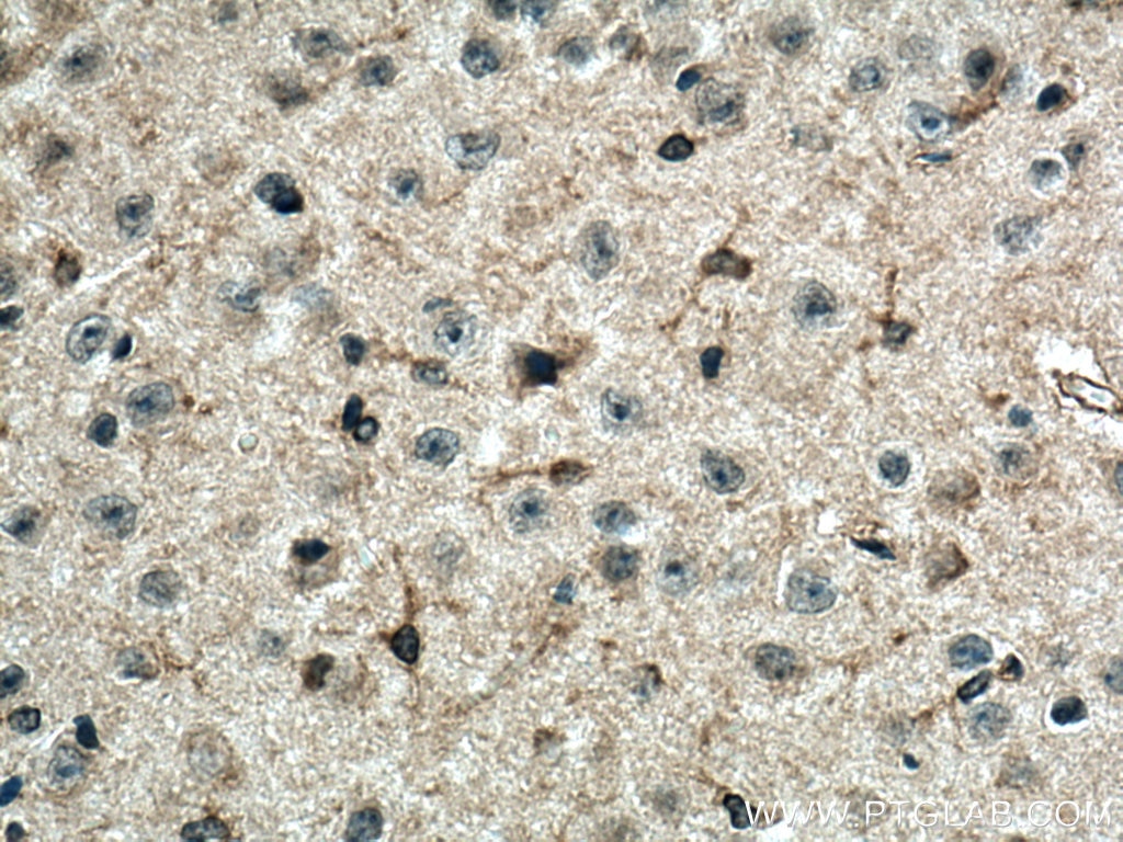 Immunohistochemistry (IHC) staining of mouse brain tissue using Orexin receptor 1 Polyclonal antibody (18370-1-AP)