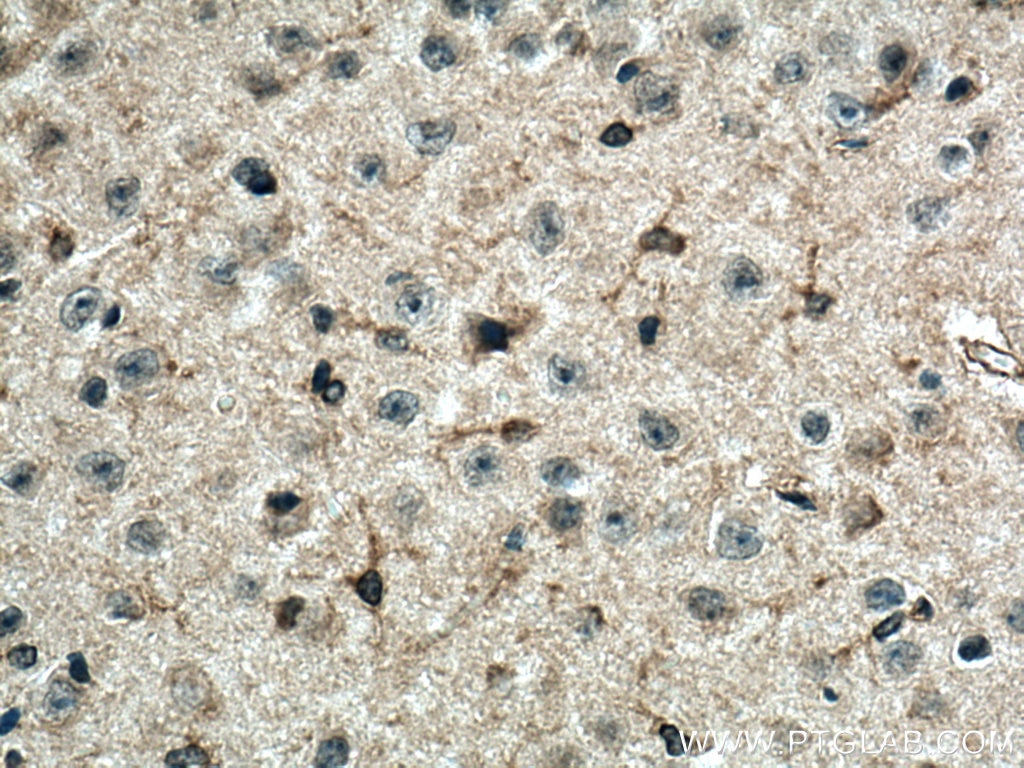 Immunohistochemistry (IHC) staining of mouse brain tissue using HCRTR1 Polyclonal antibody (18370-1-AP)