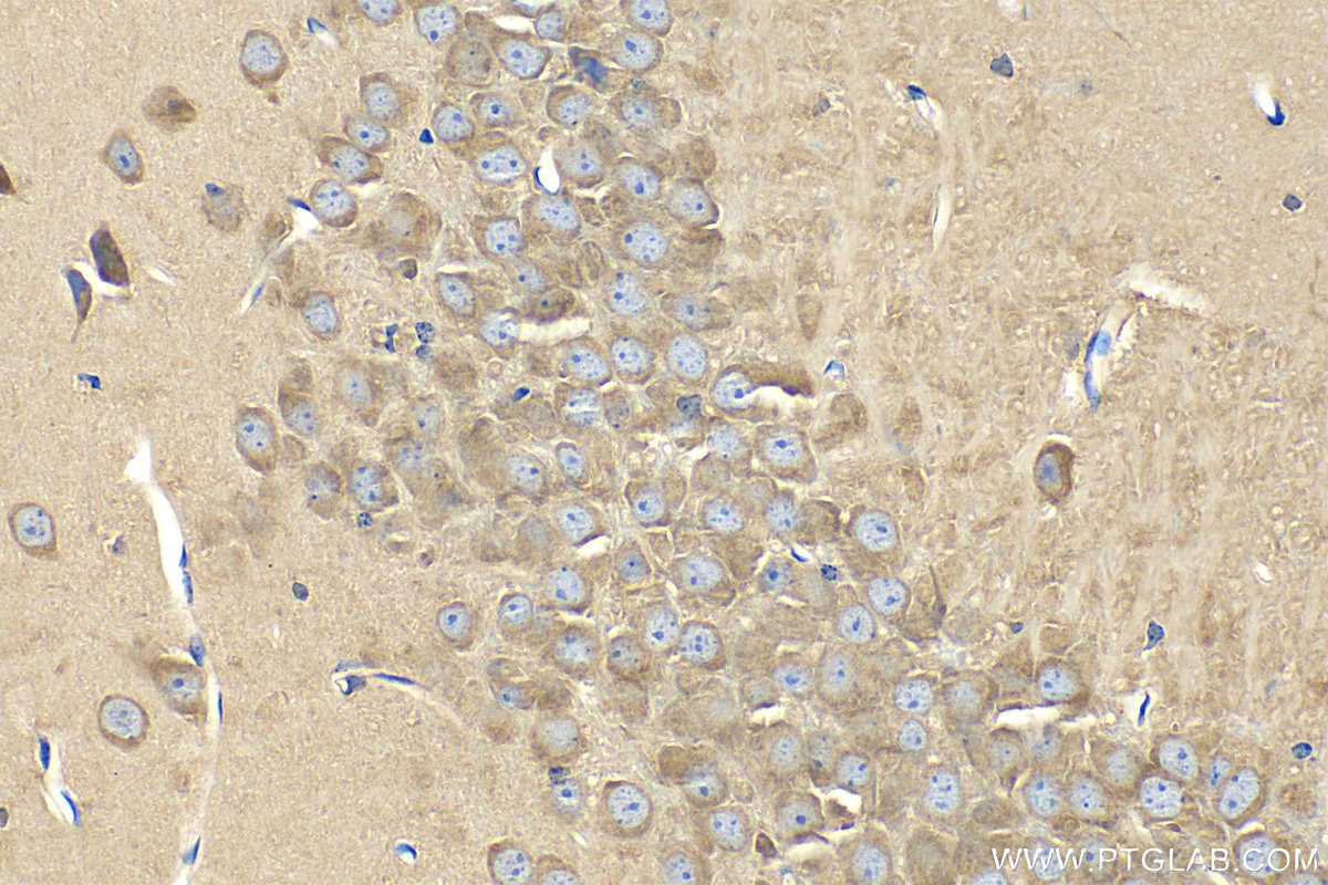 Immunohistochemistry (IHC) staining of mouse brain tissue using HCRTR1 Polyclonal antibody (18370-1-AP)