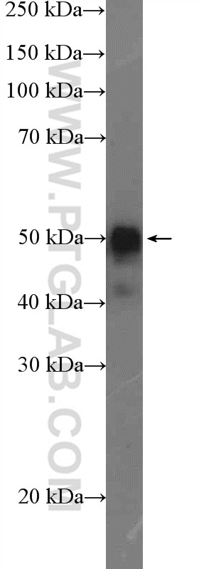 Western Blot (WB) analysis of mouse pancreas tissue using Orexin receptor 1 Polyclonal antibody (18370-1-AP)