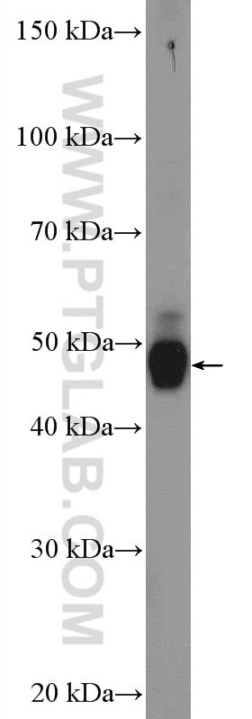 Western Blot (WB) analysis of mouse brain tissue using Orexin receptor 1 Polyclonal antibody (18370-1-AP)