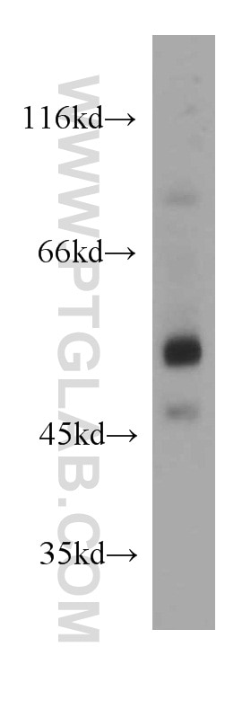 Western Blot (WB) analysis of Jurkat cells using Orexin receptor 1 Polyclonal antibody (18370-1-AP)