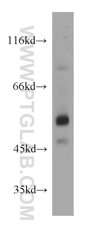 WB analysis of Jurkat using 18370-1-AP