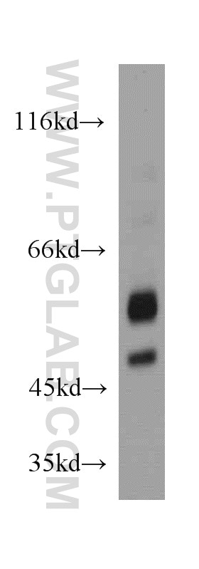 Western Blot (WB) analysis of SH-SY5Y cells using Orexin receptor 1 Polyclonal antibody (18370-1-AP)