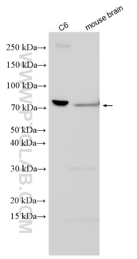 Various lysates were subjected to SDS PAGE followed by western blot with 32859-1-AP (HCRTR2 antibody) at dilution of 1:1000 incubated at room temperature for 1.5 hours. Western Blot (WB) analysis of various lysates using HCRTR2 Polyclonal antibody (32859-1-AP)