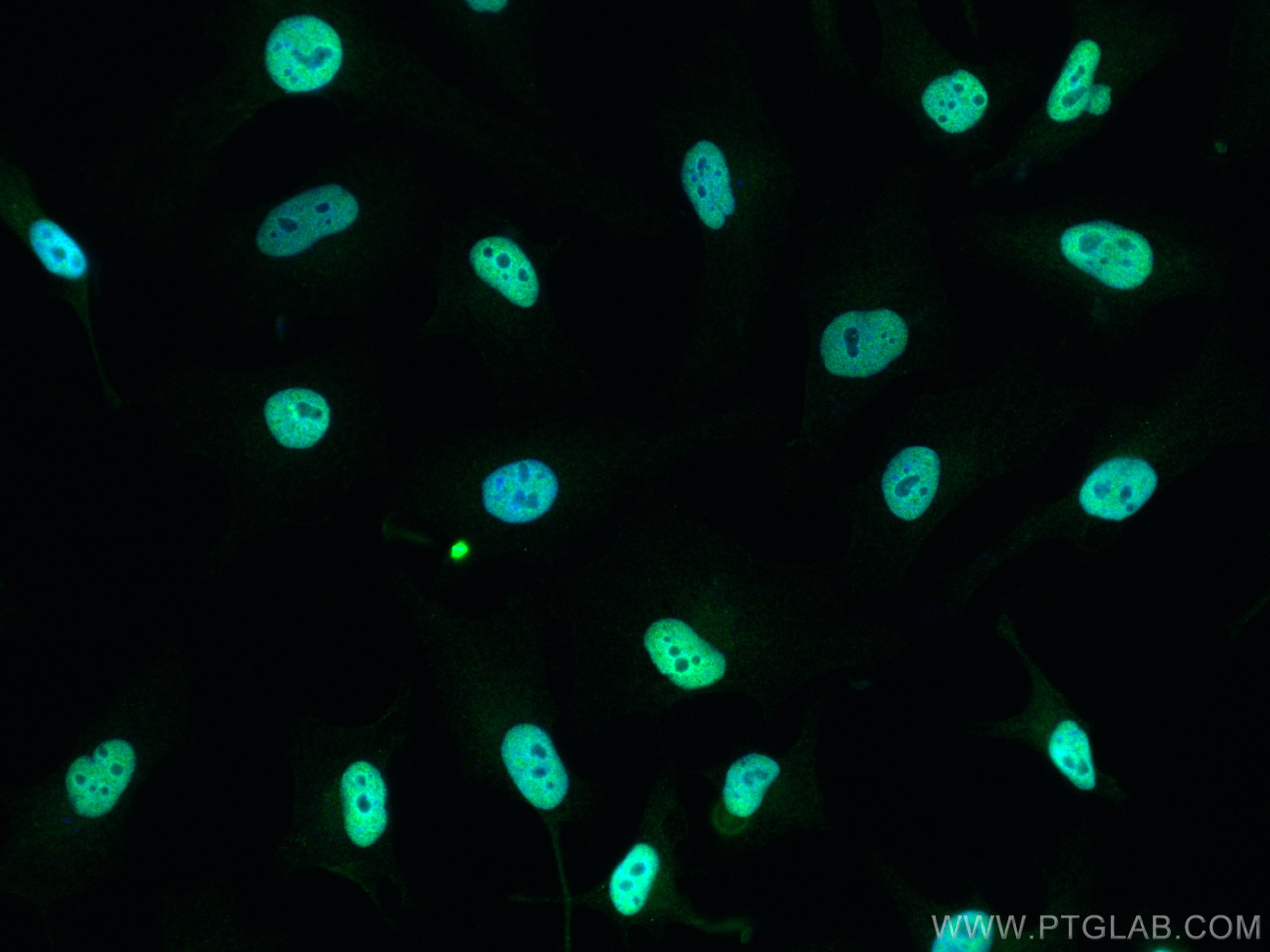 Immunofluorescence (IF) / fluorescent staining of HeLa cells using HDAC1 Polyclonal antibody (10197-1-AP)